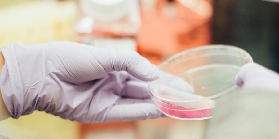 A lab technician inspecting the contents of a petri dish.