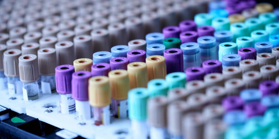 Medical laboratory equipment with test tubes for analysis.